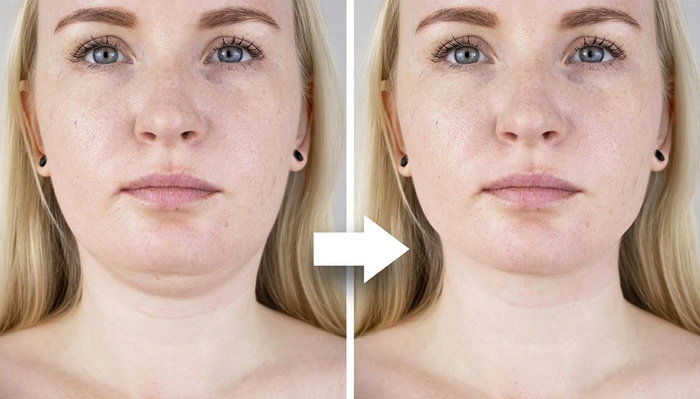 How to Retouch a Double Chin Using Photoshop