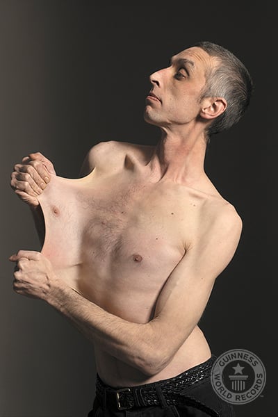 Garry-Turner-stretchiest-skin.jpg