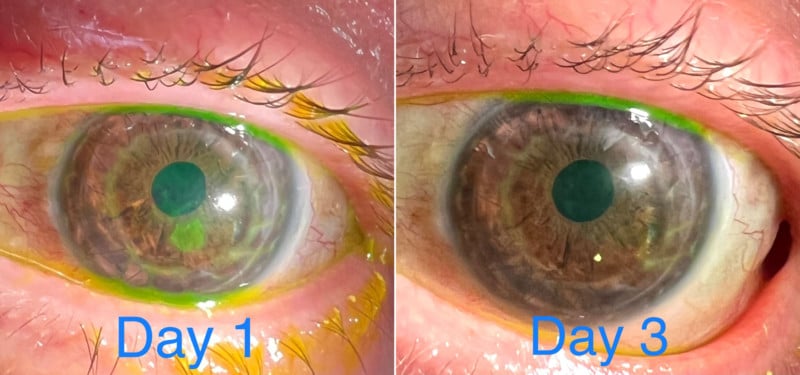 Why-This-Doctor-Uses-the-iPhone-13-Pro-to-Photograph-Patients-Eyes-example-800x375.jpg