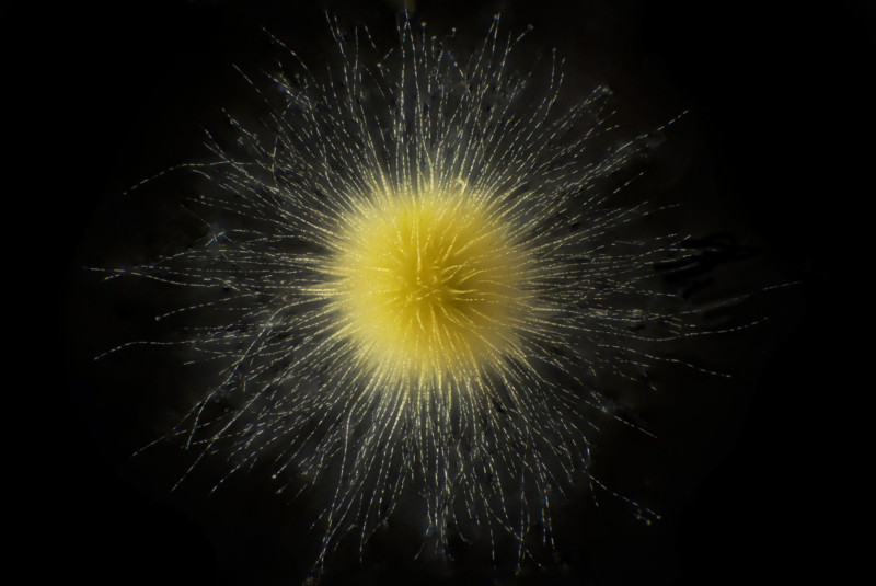 Gloeotrichia - Cyanobacteria, a yellow, spiked planton Gloeotrichia - Cyanobacteria, a yellow, spiked planton